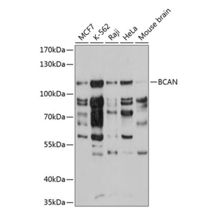 Western Blot - Anti-Brevican Antibody (A10687) - Antibodies.com
