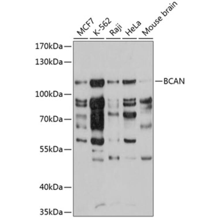 Western Blot - Anti-Brevican Antibody (A10687) - Antibodies.com