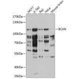 Western Blot - Anti-Brevican Antibody (A10687) - Antibodies.com