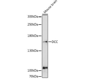 Western Blot - Anti-DCC Antibody (A10688) - Antibodies.com