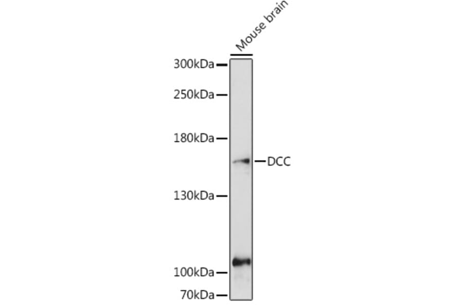 Western Blot - Anti-DCC Antibody (A10688) - Antibodies.com