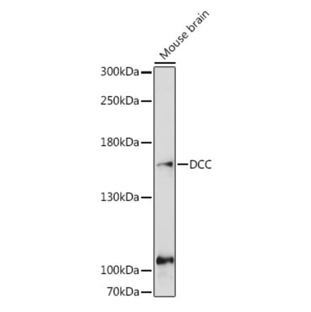 Western Blot - Anti-DCC Antibody (A10688) - Antibodies.com