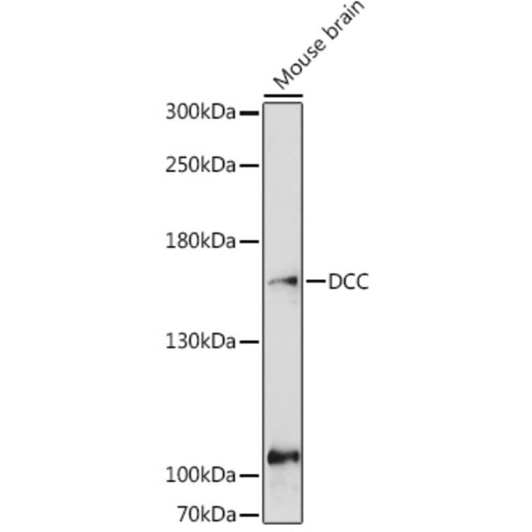 Western Blot - Anti-DCC Antibody (A10688) - Antibodies.com