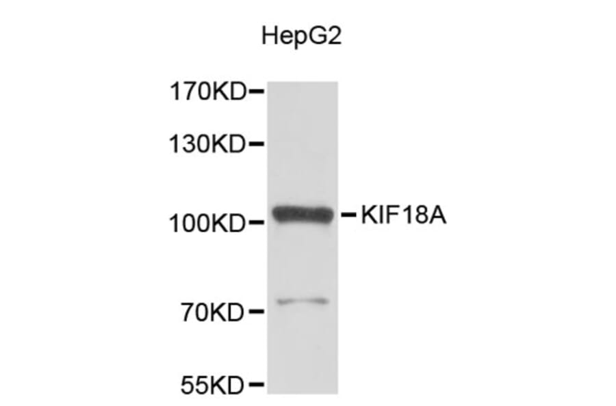 Western Blot - Anti-KIF18A Antibody (A9375) - Antibodies.com