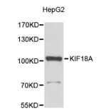 Western Blot - Anti-KIF18A Antibody (A9375) - Antibodies.com