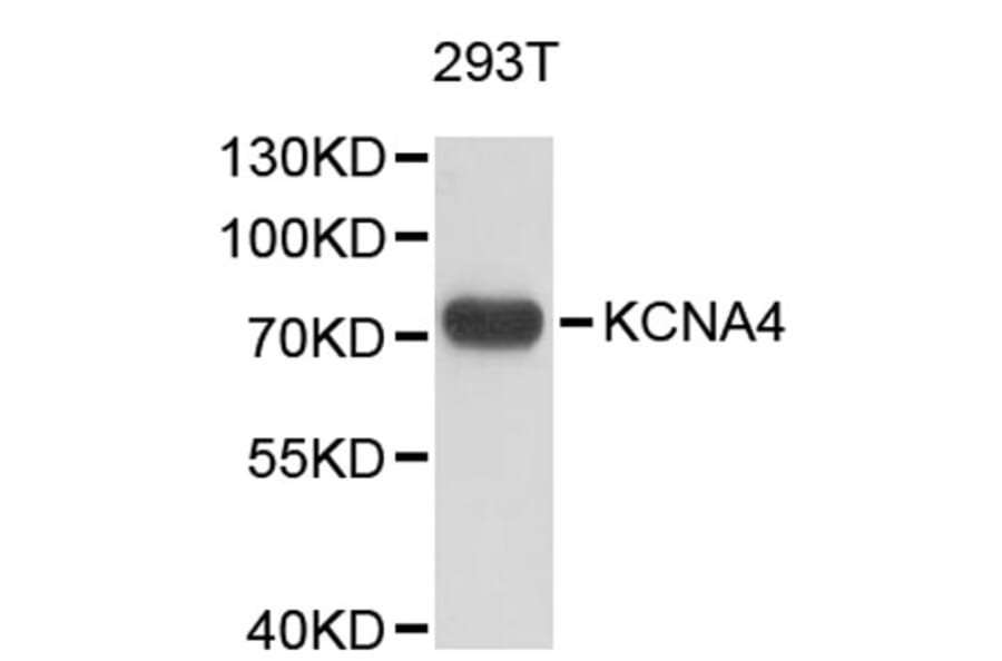 Western Blot - Anti-KCNA4 Antibody (A9389) - Antibodies.com