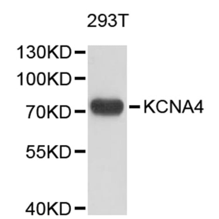Western Blot - Anti-KCNA4 Antibody (A9389) - Antibodies.com