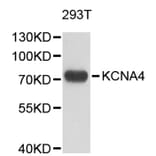 Western Blot - Anti-KCNA4 Antibody (A9389) - Antibodies.com