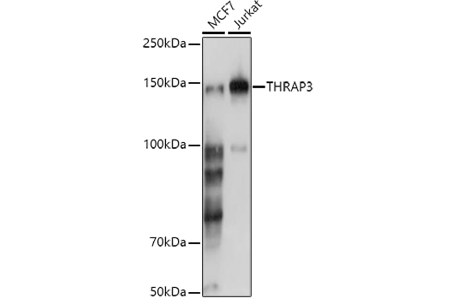 Western Blot - Anti-TR150 Antibody (A10691) - Antibodies.com