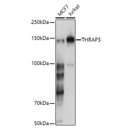 Western Blot - Anti-TR150 Antibody (A10691) - Antibodies.com