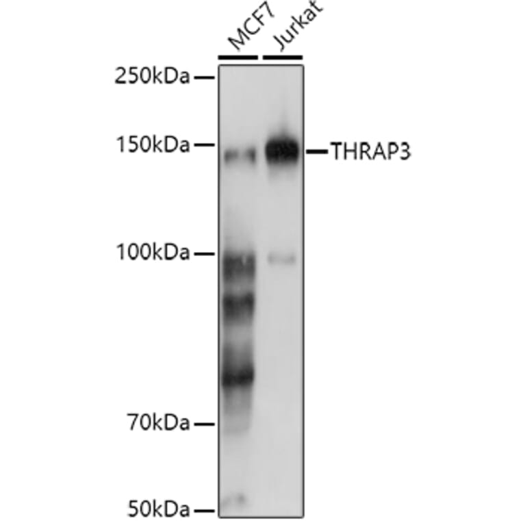 Western Blot - Anti-TR150 Antibody (A10691) - Antibodies.com