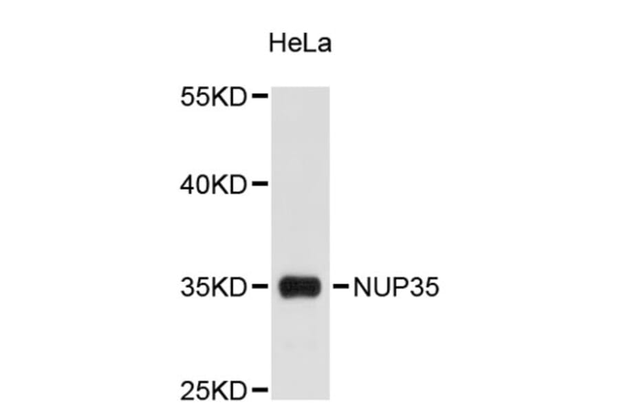 Western Blot - Anti-NUP35 Antibody (A9398) - Antibodies.com
