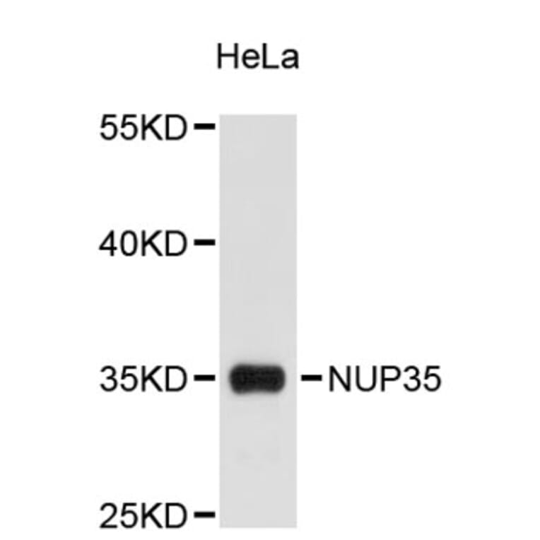 Western Blot - Anti-NUP35 Antibody (A9398) - Antibodies.com