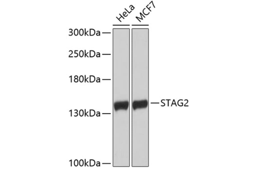 Western Blot - Anti-STAG2 Antibody (A9400) - Antibodies.com