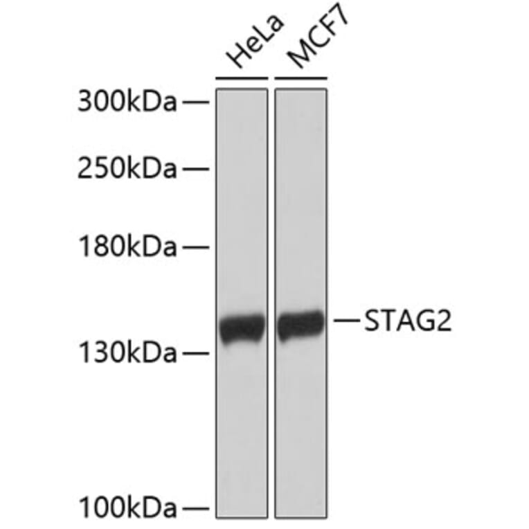 Western Blot - Anti-STAG2 Antibody (A9400) - Antibodies.com