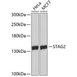 Western Blot - Anti-STAG2 Antibody (A9400) - Antibodies.com
