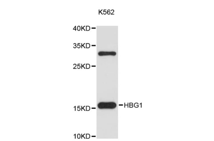 Western Blot - Anti-HBG1 Antibody (A9402) - Antibodies.com