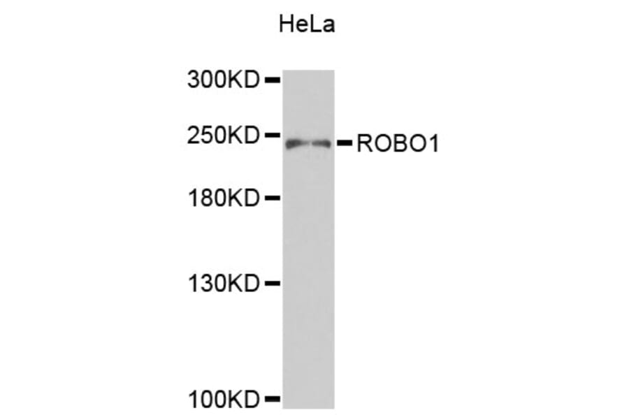 Western Blot - Anti-ROBO1 Antibody (A9412) - Antibodies.com
