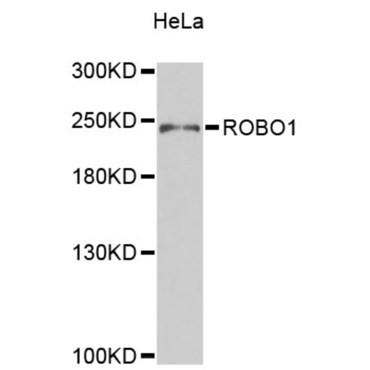 Western Blot - Anti-ROBO1 Antibody (A9412) - Antibodies.com