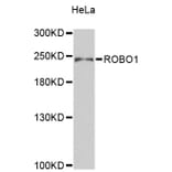 Western Blot - Anti-ROBO1 Antibody (A9412) - Antibodies.com