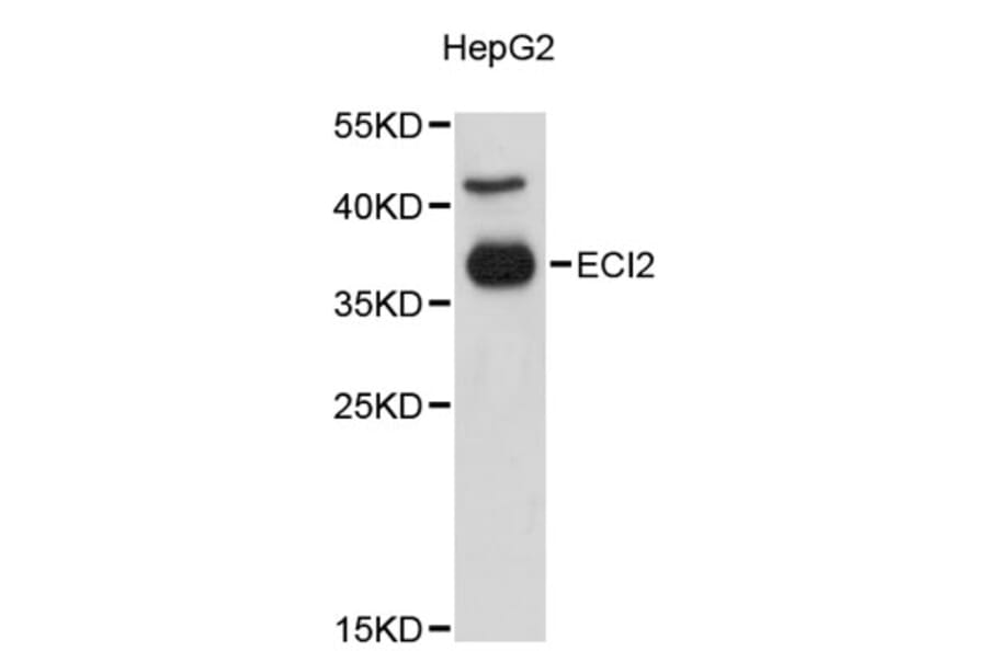 Western Blot - Anti-ECI2 Antibody (A9422) - Antibodies.com