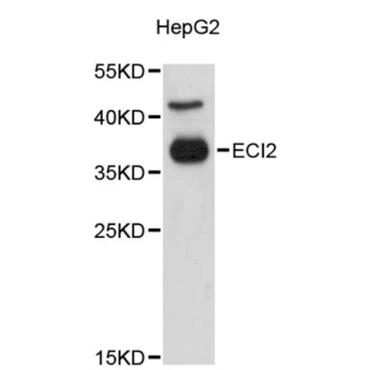 Western Blot - Anti-ECI2 Antibody (A9422) - Antibodies.com