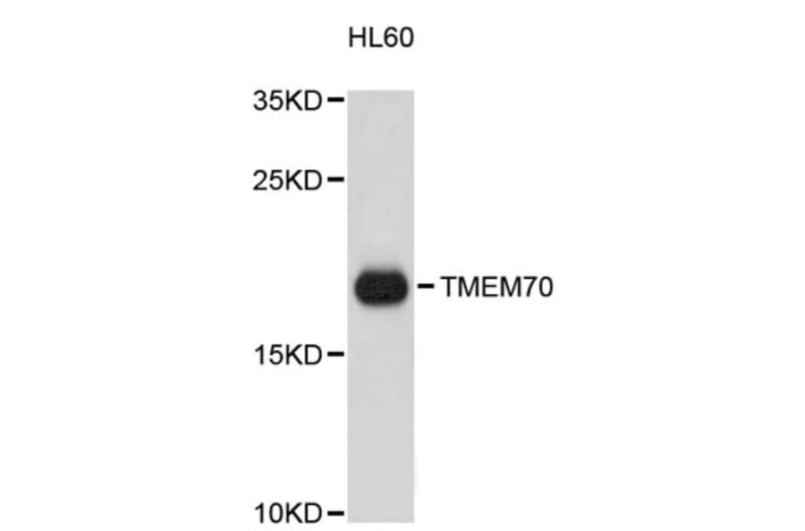 Western Blot - Anti-TMEM70 Antibody (A9423) - Antibodies.com