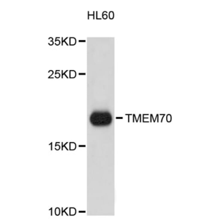 Western Blot - Anti-TMEM70 Antibody (A9423) - Antibodies.com
