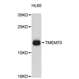 Western Blot - Anti-TMEM70 Antibody (A9423) - Antibodies.com