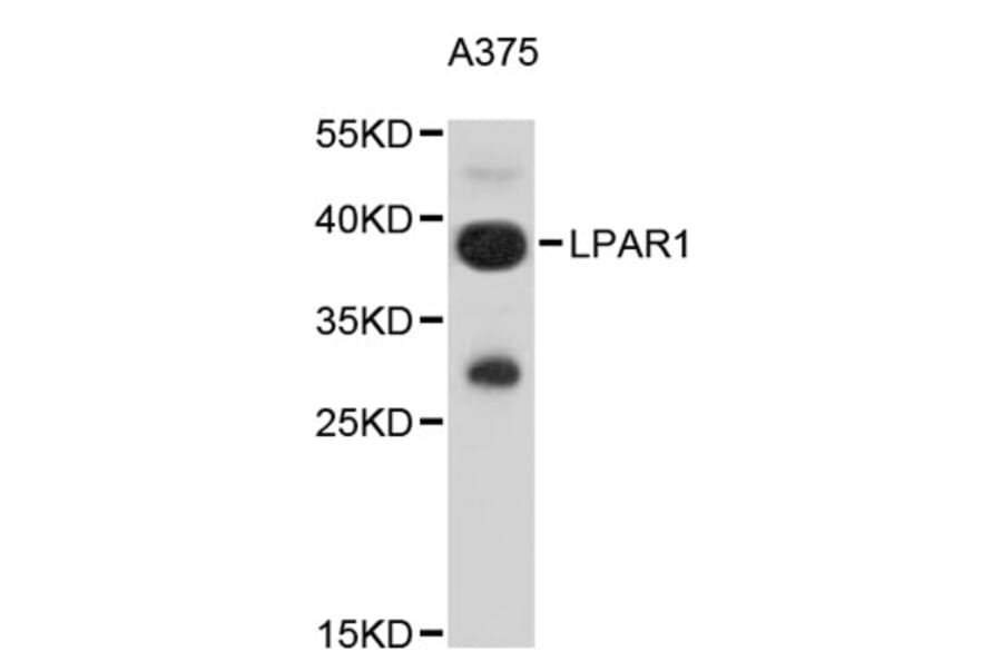 Western Blot - Anti-LPAR1 Antibody (A9424) - Antibodies.com