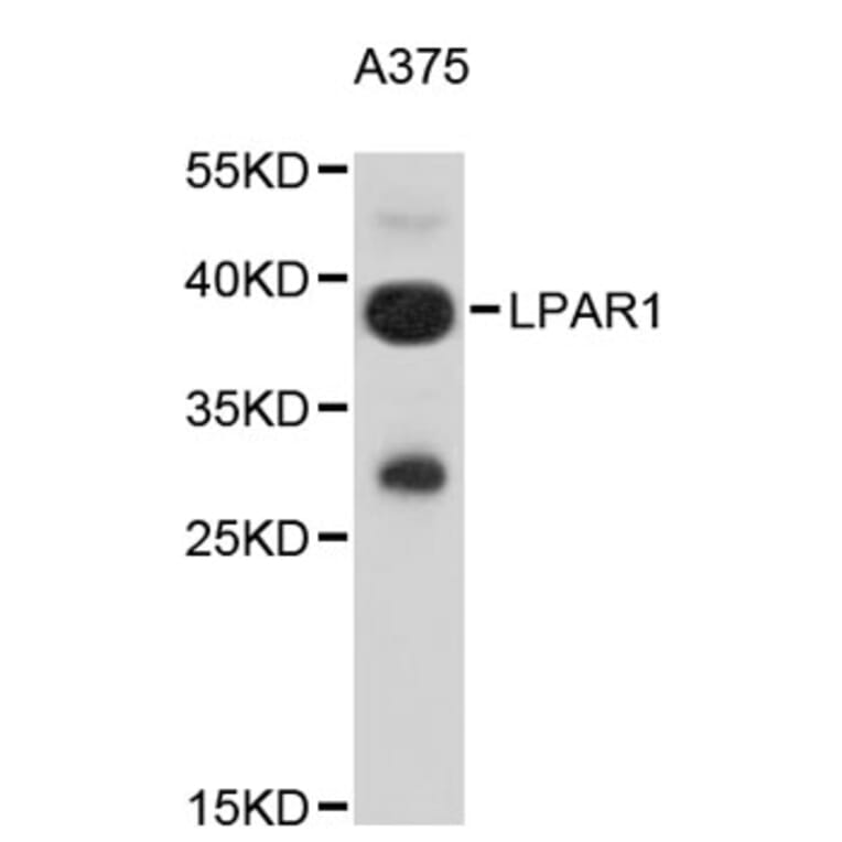 Western Blot - Anti-LPAR1 Antibody (A9424) - Antibodies.com