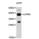 Western Blot - Anti-LPAR1 Antibody (A9424) - Antibodies.com