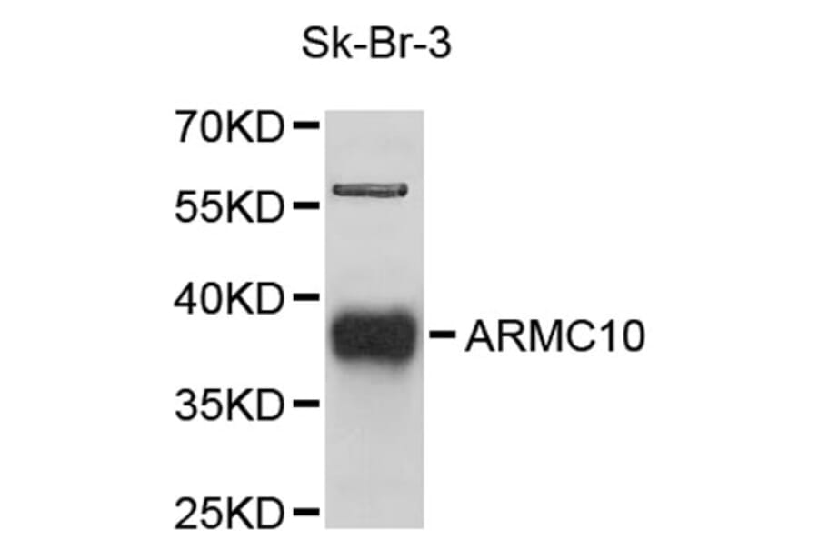 Western Blot - Anti-ARMC10 Antibody (A9427) - Antibodies.com