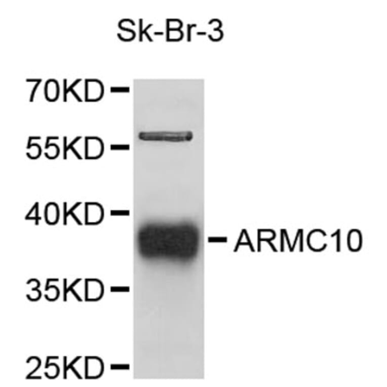 Western Blot - Anti-ARMC10 Antibody (A9427) - Antibodies.com