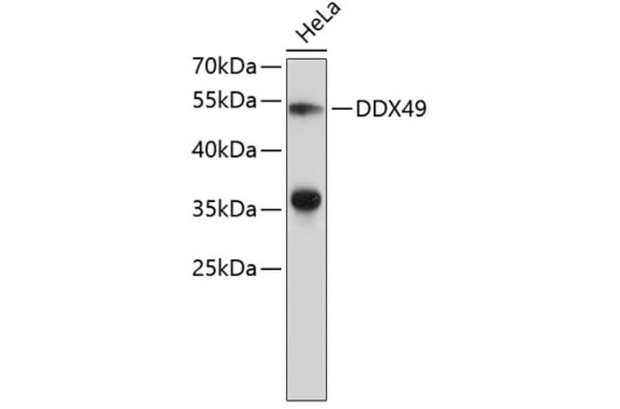 Western Blot - Anti-DDX49 Antibody (A9428) - Antibodies.com
