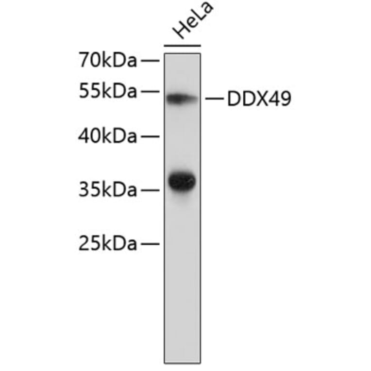 Western Blot - Anti-DDX49 Antibody (A9428) - Antibodies.com