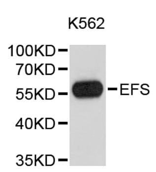 Western blot analysis of extracts of K-562 cells, using Anti-EFS Antibody (A9429).
Secondary antibody: Goat Anti-Rabbit IgG (H+L) (HRP) (AS014) at 1:10,000 dilution.
Lysates / proteins: 25µg per lane.
Blocking buffer: 3% non-fat dry milk in TBST.
