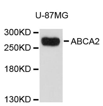 Western blot analysis of extracts of U-87MG cells, using Anti-ABCA2 Antibody (A9436).
Secondary antibody: Goat Anti-Rabbit IgG (H+L) (HRP) (AS014) at 1:10,000 dilution.
Lysates / proteins: 25µg per lane.
Blocking buffer: 3% non-fat dry milk in TBST.
