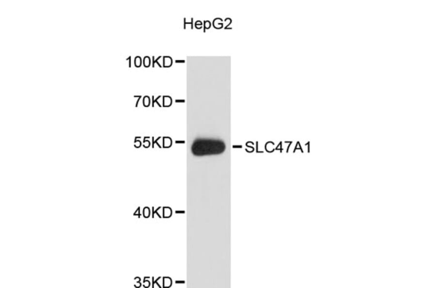 Western Blot - Anti-SLC47A1 Antibody (A9444) - Antibodies.com