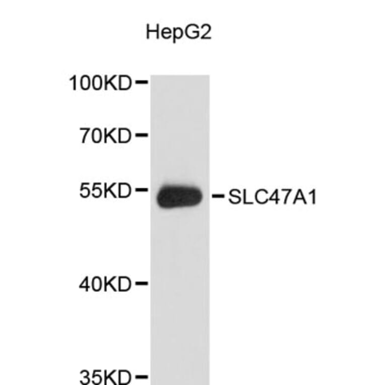 Western Blot - Anti-SLC47A1 Antibody (A9444) - Antibodies.com