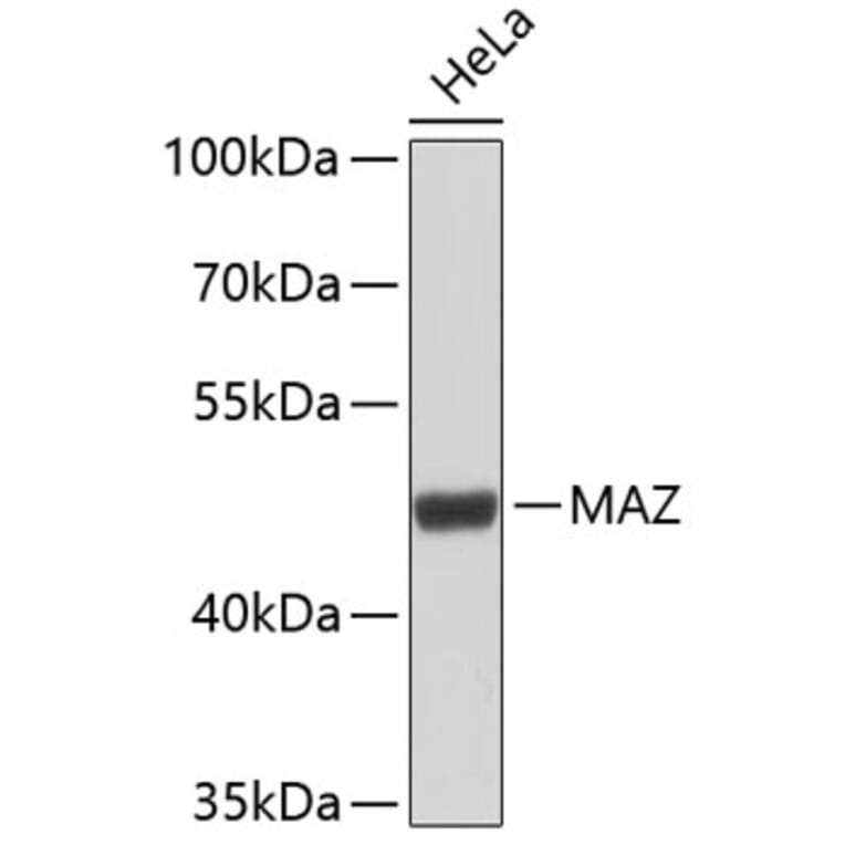 Western Blot - Anti-MAZ Antibody (A9451) - Antibodies.com