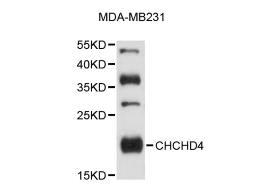 Western Blot - Anti-CHCHD4 Antibody (A9453) - Antibodies.com