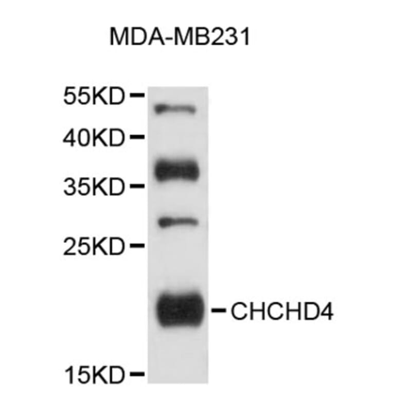 Western Blot - Anti-CHCHD4 Antibody (A9453) - Antibodies.com