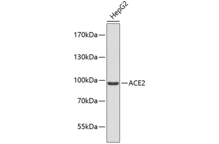 Western Blot - Anti-ACE2 Antibody (A9454) - Antibodies.com