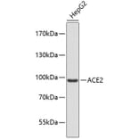 Western Blot - Anti-ACE2 Antibody (A9454) - Antibodies.com