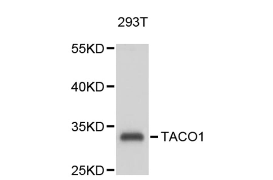 Western Blot - Anti-TACO1 Antibody (A9457) - Antibodies.com