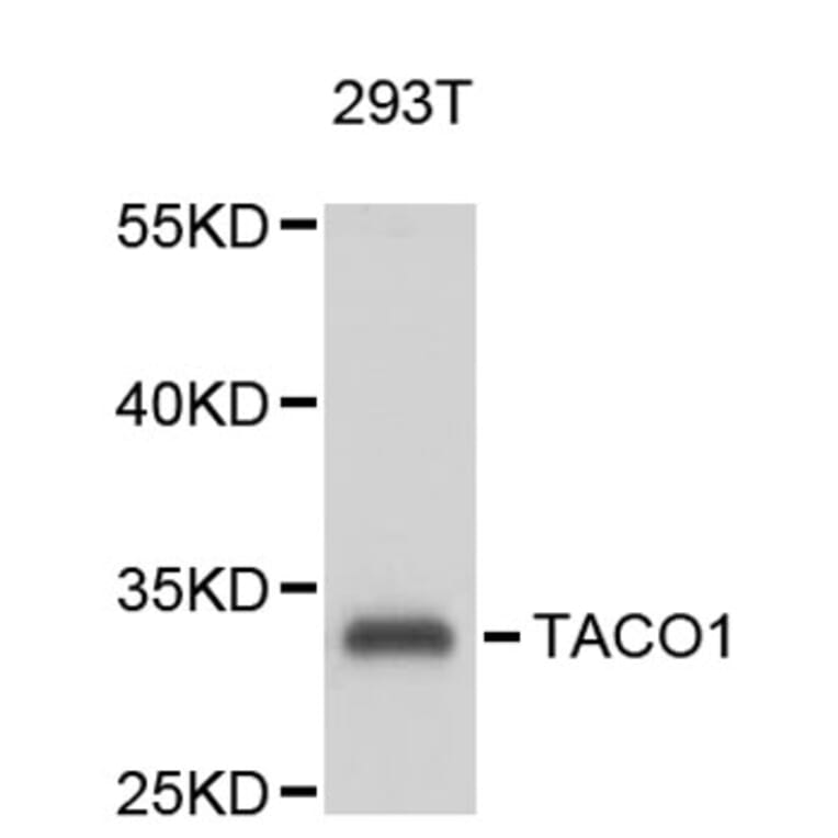 Western Blot - Anti-TACO1 Antibody (A9457) - Antibodies.com