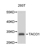Western Blot - Anti-TACO1 Antibody (A9457) - Antibodies.com