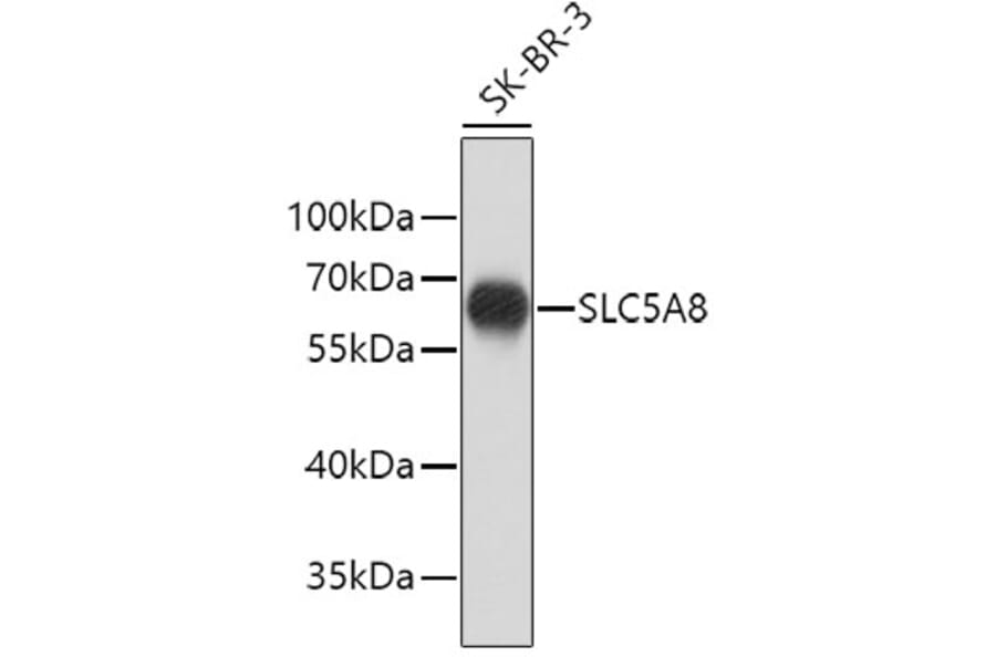 Western Blot - Anti-SLC5A8 Antibody (A9463) - Antibodies.com
