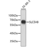 Western Blot - Anti-SLC5A8 Antibody (A9463) - Antibodies.com